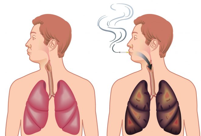 longen stoppen met roken